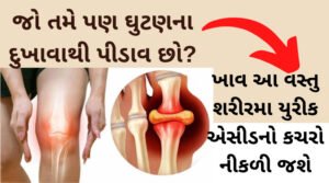 uric acid treatment